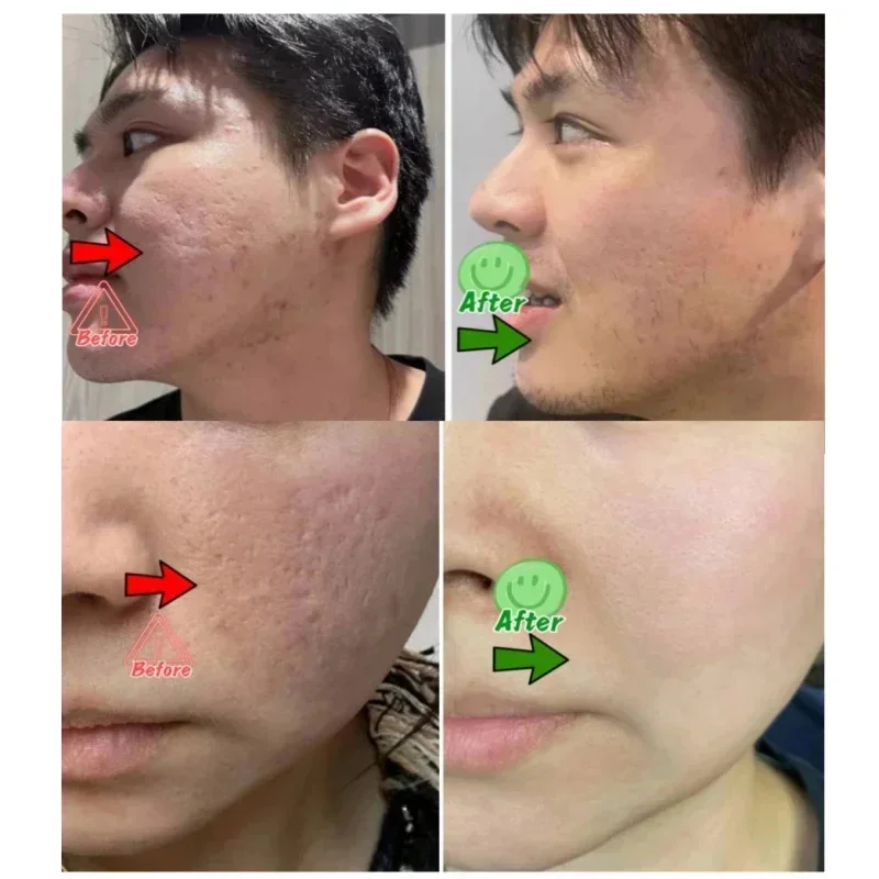 Salicylic Acid Pore Clearing C - Korean Skincare Routine recension och pris